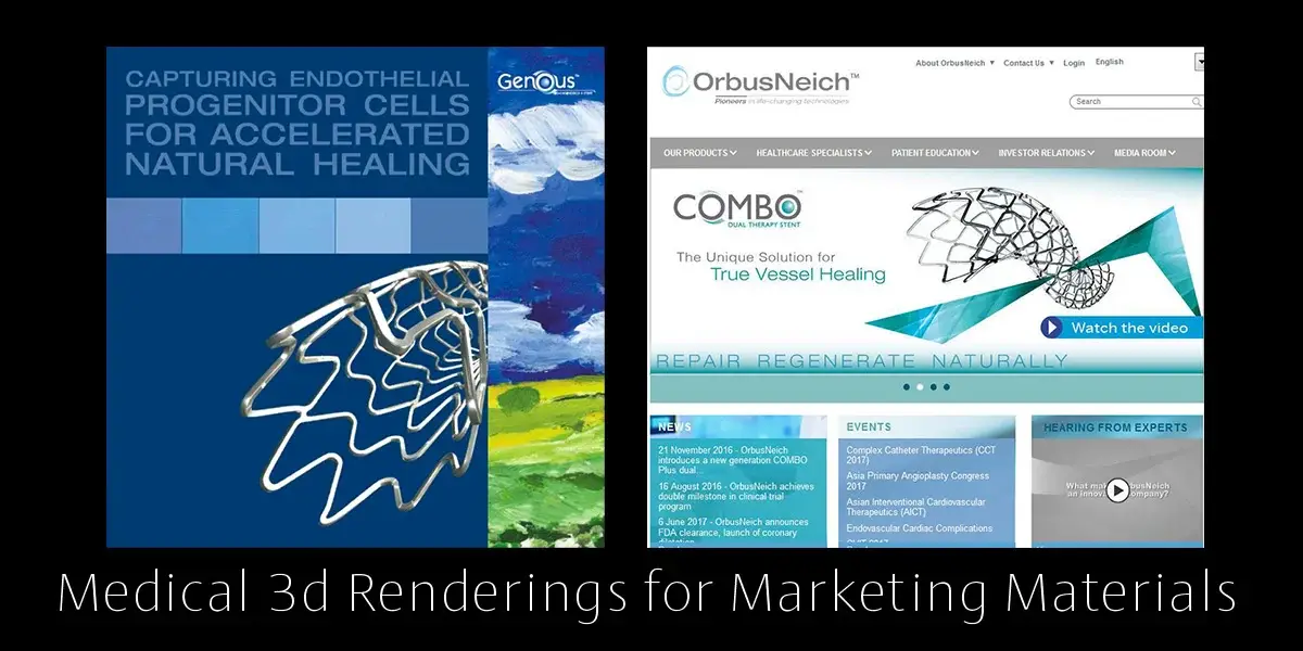 High-End Medical 3d Renderings for Marketing Materials