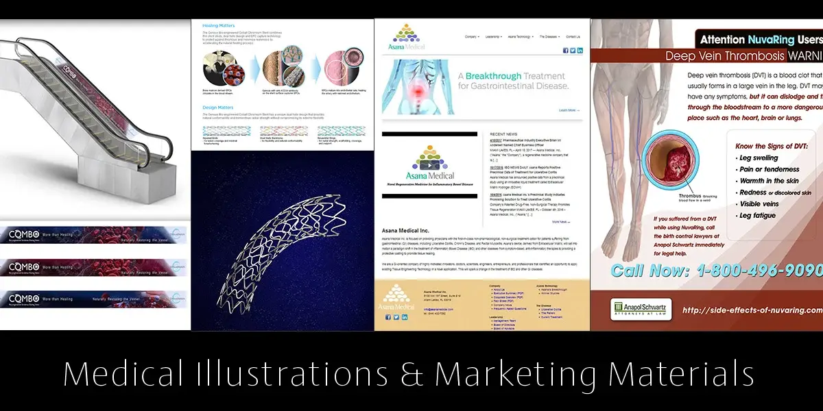 High-End 3d Renderings for Marketing Materials Medical Illustrations & Marketing Materials for Print